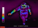 Thermal image